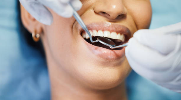 Best Emergency Dental Care for Broken or Chipped Teeth in Texkana, AR