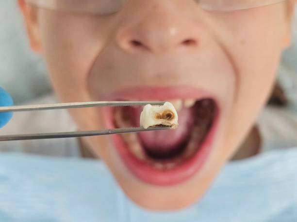 Best Same-Day Emergency Dental Services in Texkana, AR